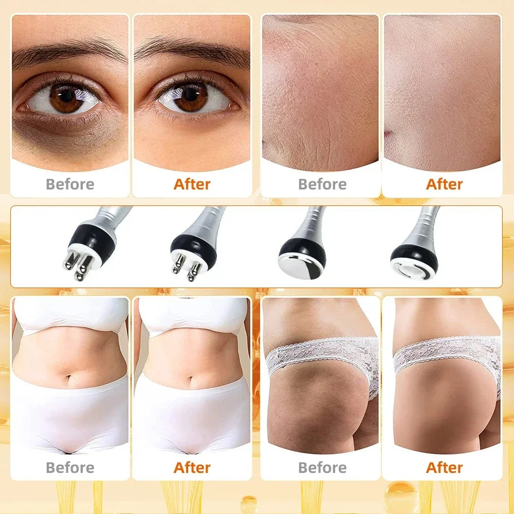 40K 3/4 IN 1 Cavitation  Body Slimming Machine Facial Massager Skin Tighten Face Lifting Vacuum Suction Beauty Device