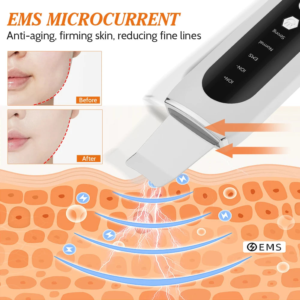 Skin Scrubber Ultrasonic Facial Machine for Home Use Spatula for Blackhead Remover Shovel Peeling Pore Cleaner Face Lift Massage